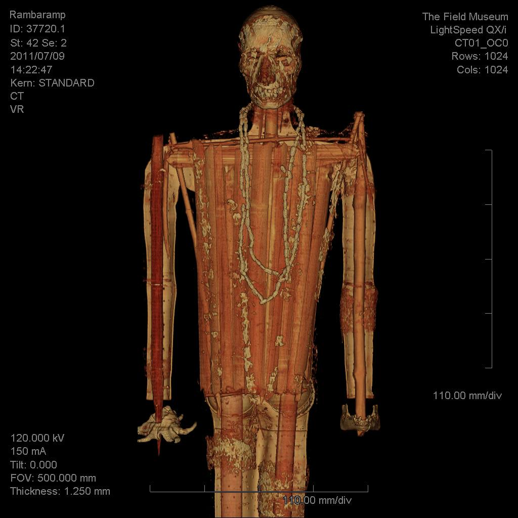 CT scan of a mummy